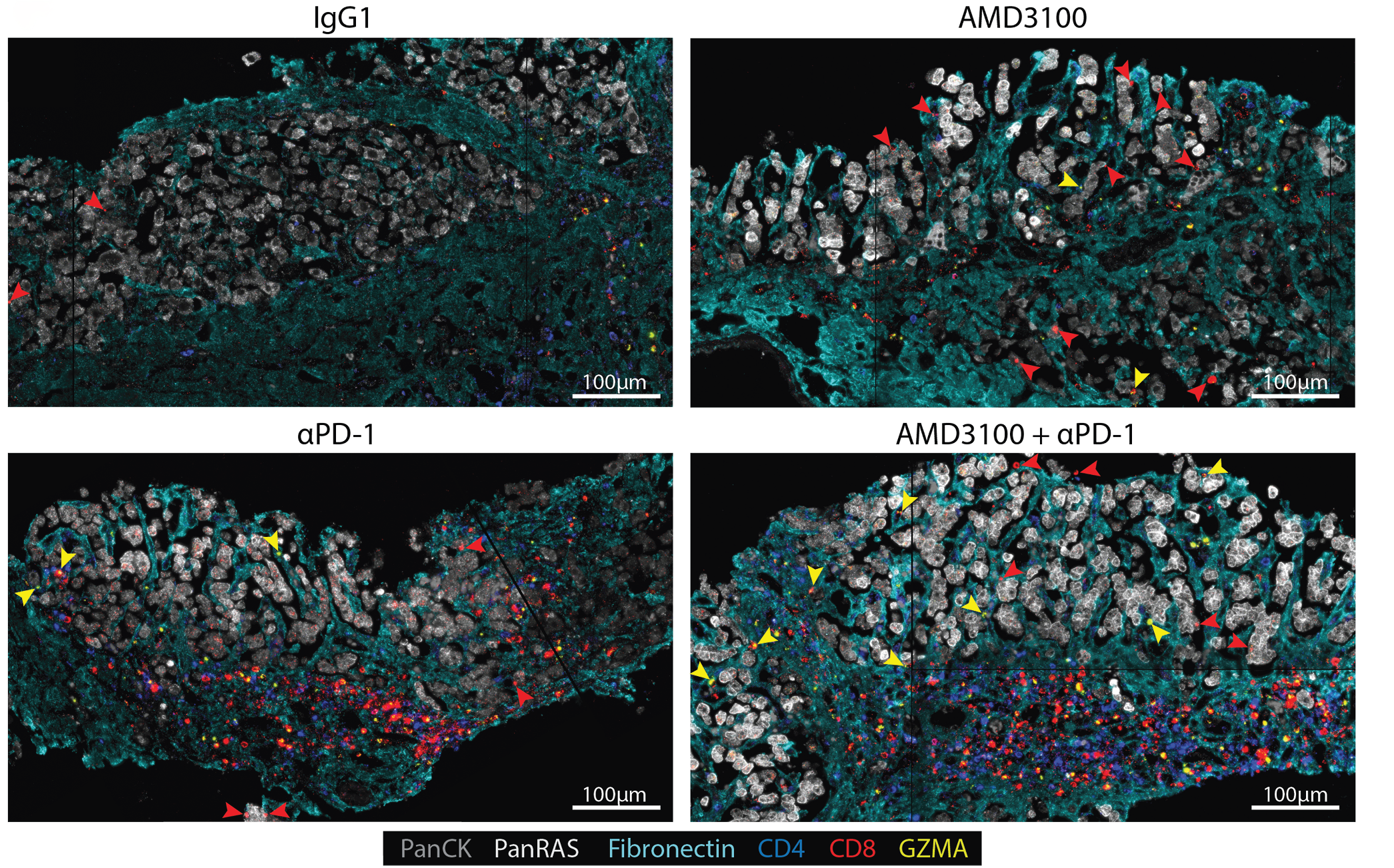 FLC Immunofluorescence 